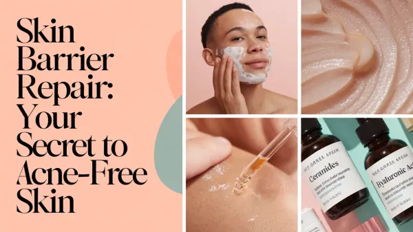 Skin Barrier Repair for Acne
