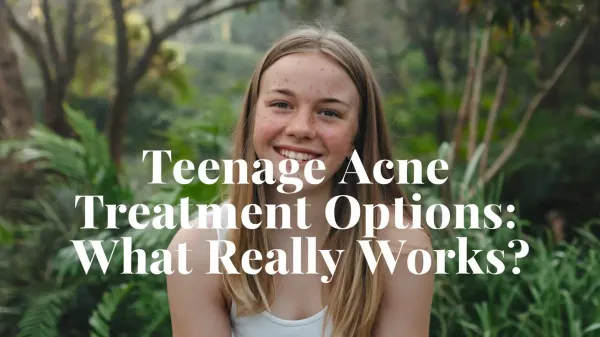 Teenage Acne Treatment Options: What Really Works?